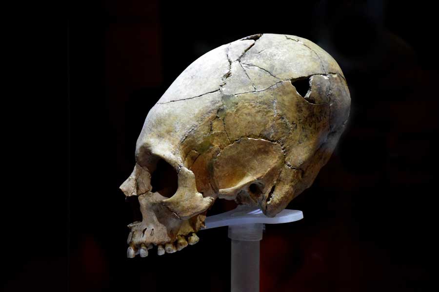 Hatay Arkeoloji Müzesi Sivriltilmiş Kafatası Tell Şeyh Höyük Kalkolitik Çağ - Hatay Archeology Museum Pointed Head Skull Chalco